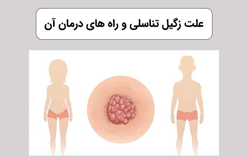 زگیل تناسلی چیست و چگونه تشخیص داده می‌شود؟